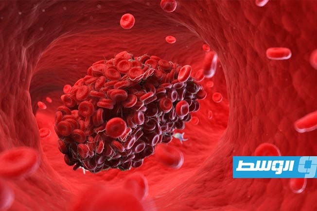 دراسة: الإجهاد النفسي يعيد تشكيل بنية الدم في دقائق معدودة