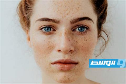 تخلصي من النمش بمكونات طبيعية من مطبخك
