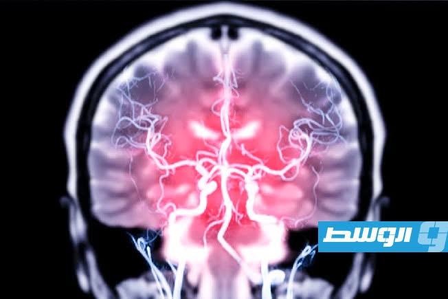 مادة كيميائية في الدماغ قد تسهم في علاج الاضطرابات النفسية والعصبية